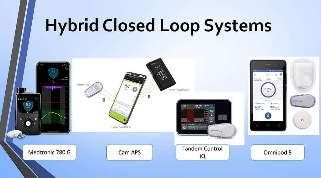 Current commercially available AID systems in the UK (January 2026)