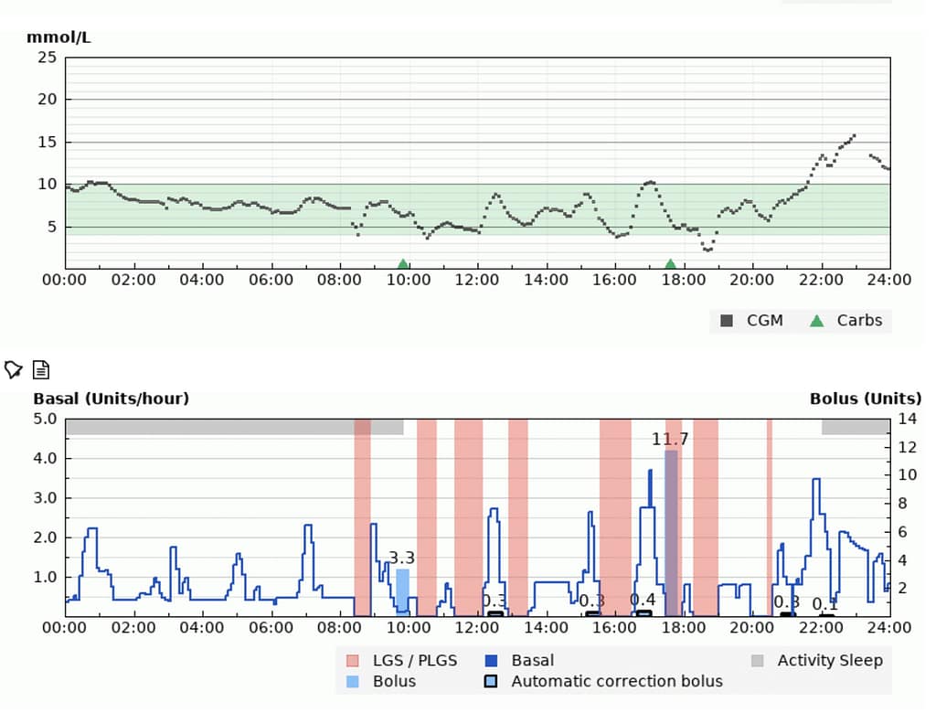 How AID systems work: insulin adjustments over time