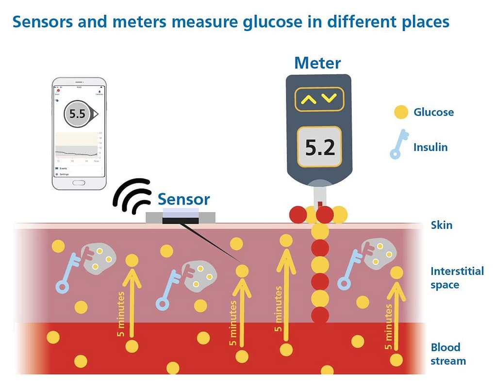 Overview of CGM with trend arrows